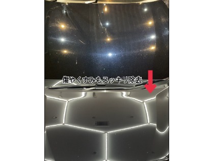 シミや傷で悩んでませんか？